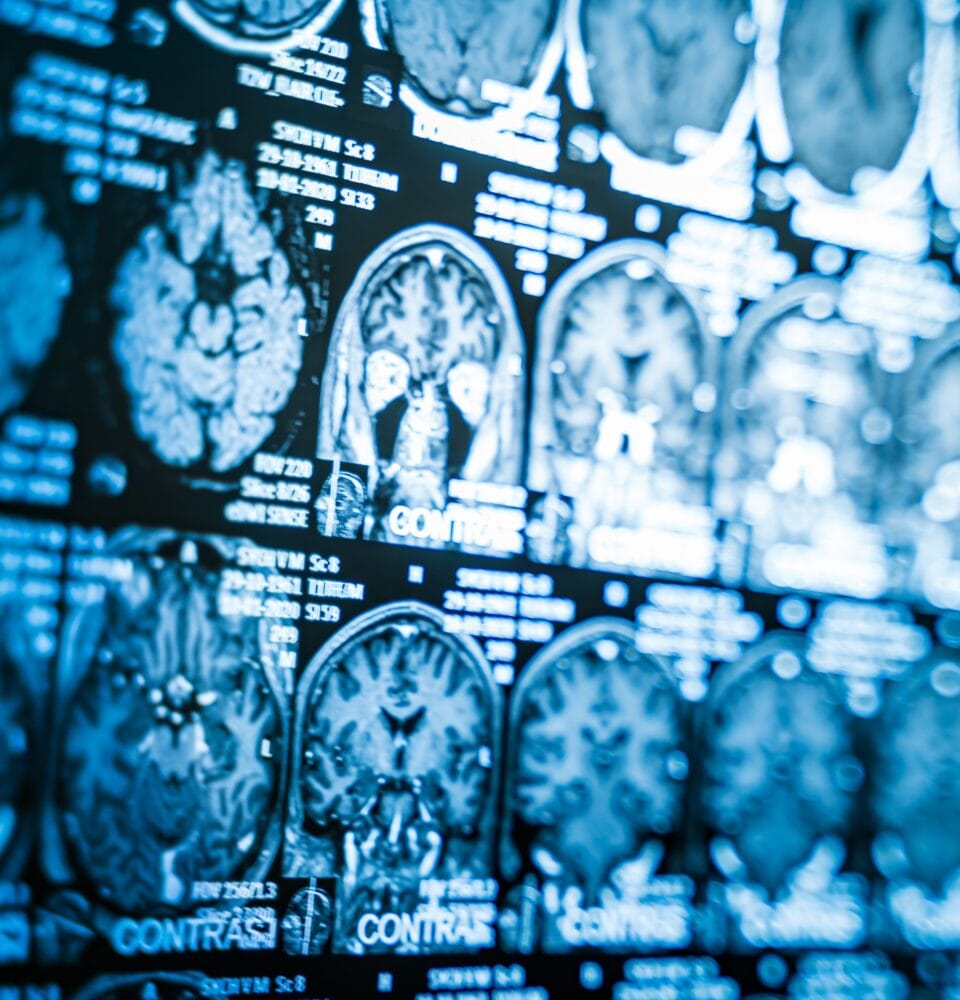 Cyfrowy bliźniak w diagnostyce obrazowej